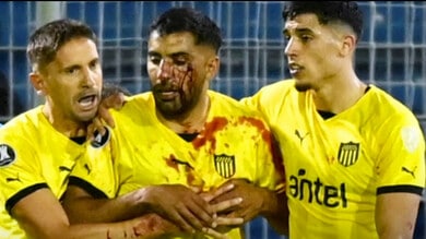 uruguay-sotto-shock-lex-fiorentina-e-una-maschera-di-sangue-cosa-e-successo-2,