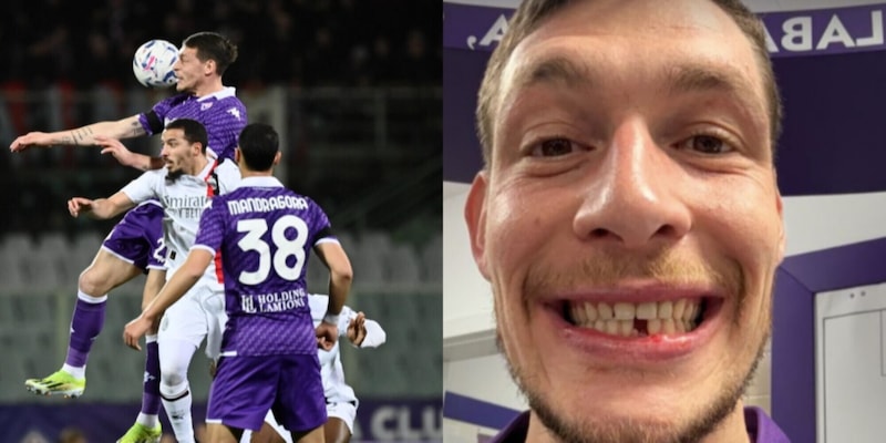 fiorentina-belotti-perde-un-dente-la-reazione-della-moglie-e-virale-2,