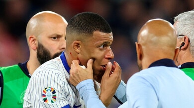 Mbappé, niente operazione al naso: "Idee per una maschera?"