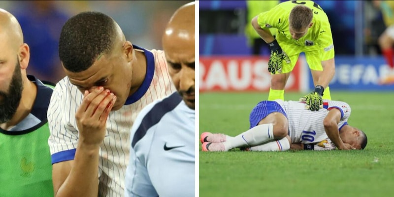 Francia in ansia per Mbappé: "Non sta messo bene"