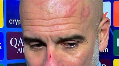 Guardiola shock si presenta ridotto così: “Voglio farmi male” 1 Guardiola shock si presenta ridotto così: “Voglio farmi male”