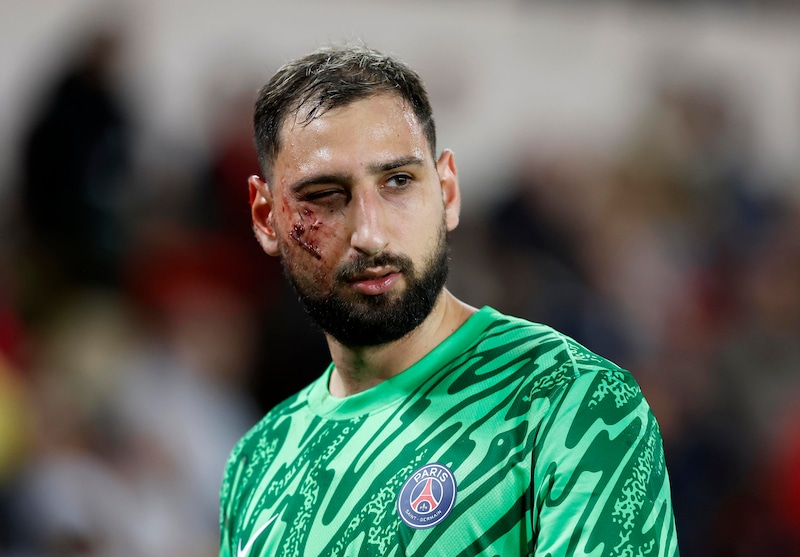 Donnarumma e il fallo shock, a Singo offese razziste. Il Monaco non ci sta