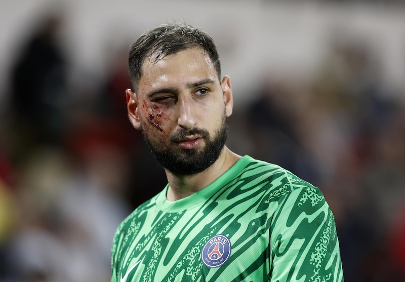 Insulti razzisti e minacce a Singo dopo il brutto fallo su Donnarumma: interviene il Monaco