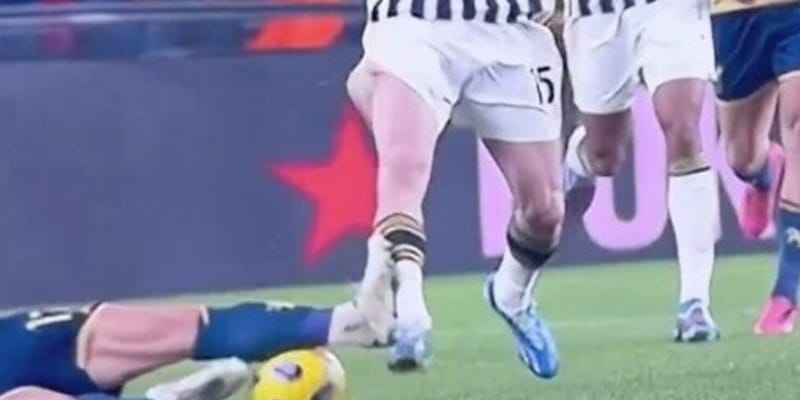 Allegri negli spogliatoi, intervento killer su Yildiz: chi arbitra Juve-Milan