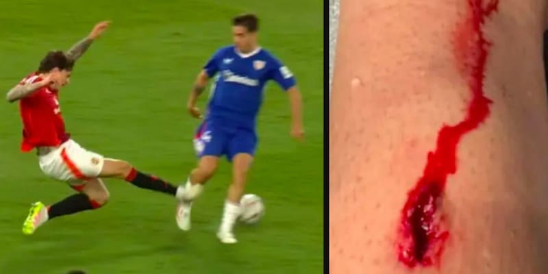 La foto raccapricciante del taglio sulla gamba in United-Athletic: "Per l'arbitro neanche fallo..." 15 La foto raccapricciante del taglio sulla gamba in United-Athletic: "Per l'arbitro neanche fallo..."