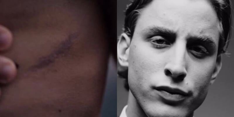 Bove, che emozione: in un video mostra per la prima volta la cicatrice sul petto