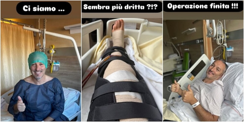 Zambrotta si opera, poi mostra la gamba sui social e scherza dopo l'intervento: "Sembra più dritta?"