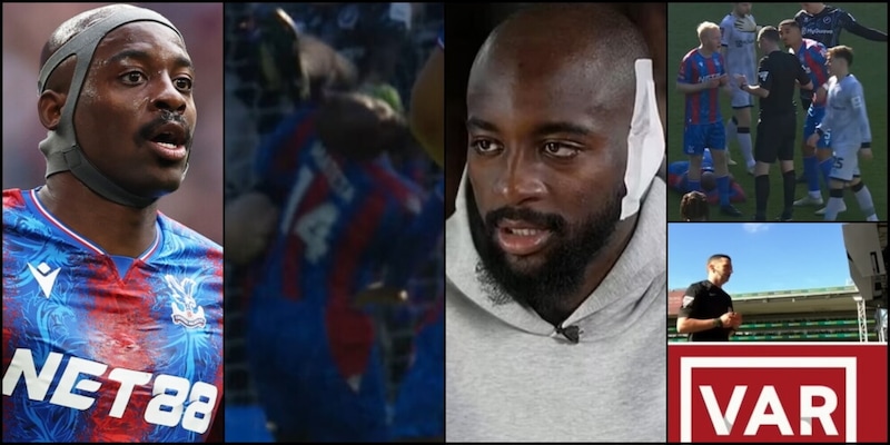 "Paura di emorragia cerebrale": Mateta shock, ma che imbarazzo Oliver! Chi &egrave; l'obiettivo Juve