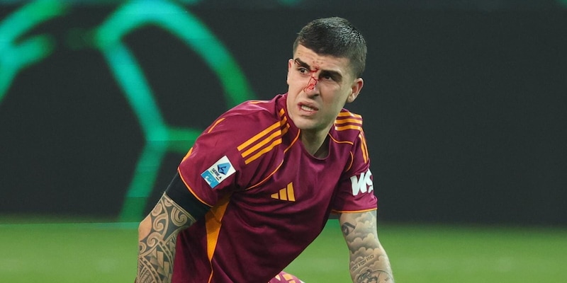 Mancini, intervento riuscito per la frattura al naso: dovr&agrave; indossare una maschera protettiva