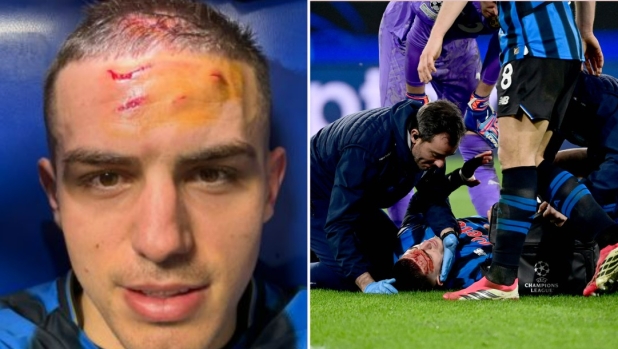 Krstović mostra le ferite in testa, Bergamo in estasi. I compagni: "Sei il nostro eroe"