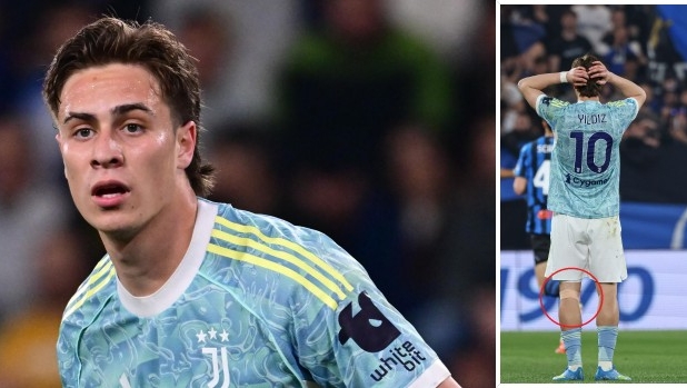 Il Mondiale può attendere: Yildiz stringe i denti per la Juve. Il piano per gestirlo