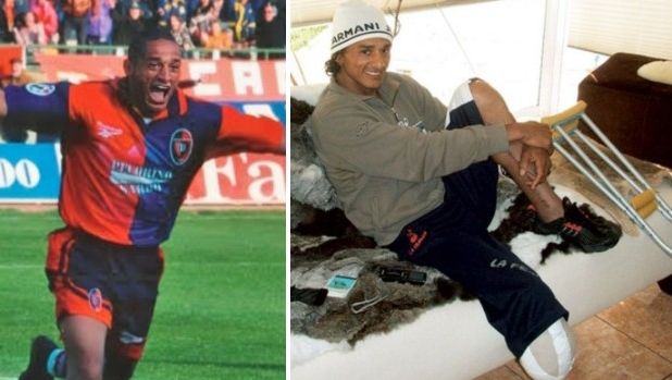 Dario Silva: "Per una fetta di torta ho perso una gamba. Volevo solo morire, ora so cos'è la felicità"