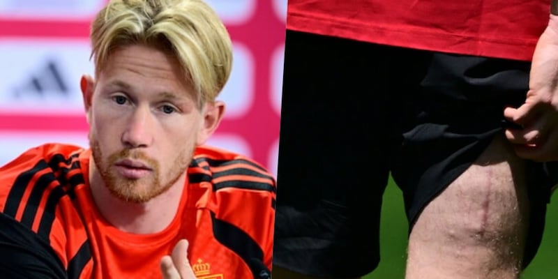 Tutte le verit&agrave; di De Bruyne: il Napoli, Lukaku, il futuro e quella cicatrice...